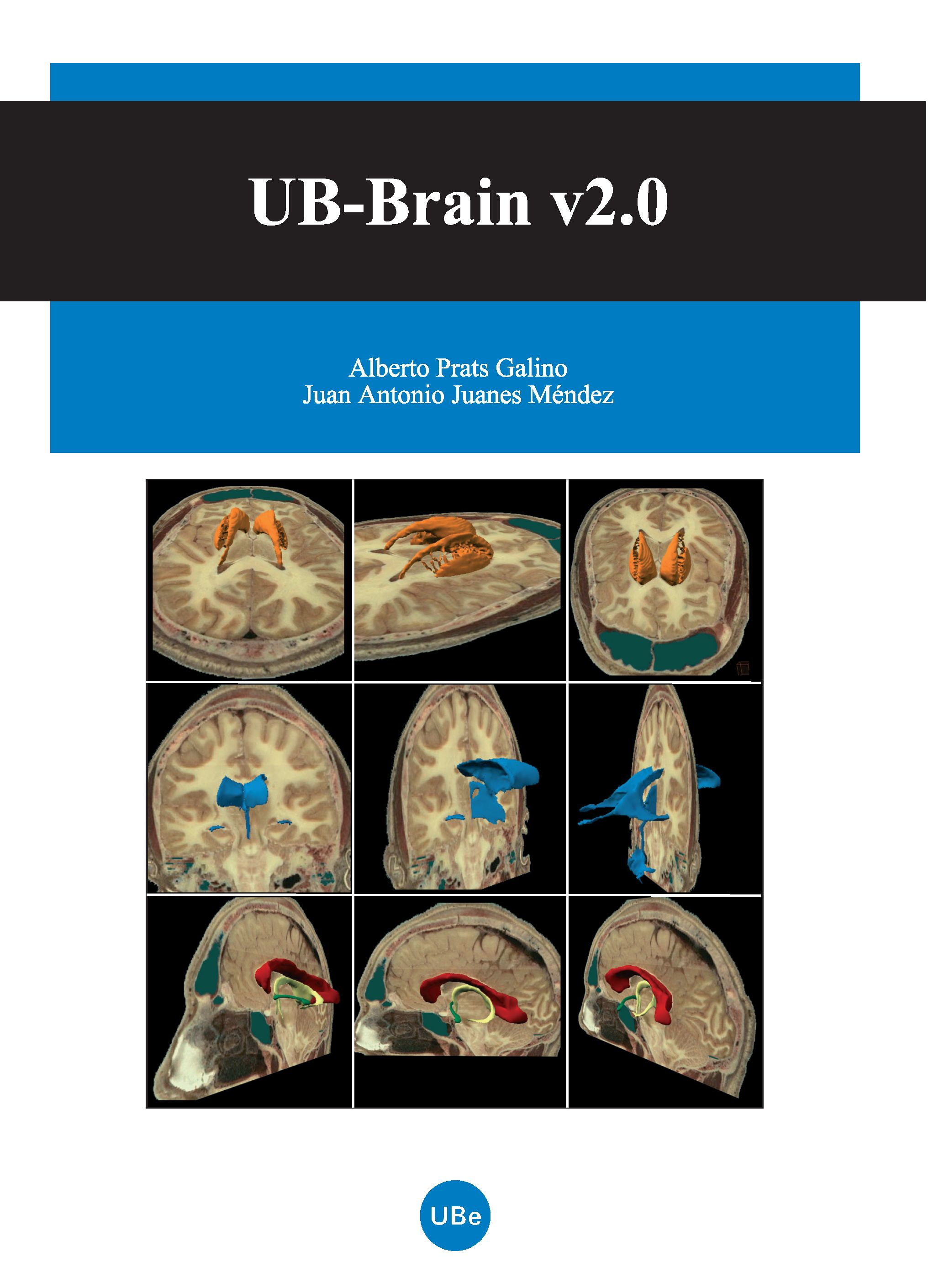 UB-Brain v2.0 (Llibre+CD-Rom)