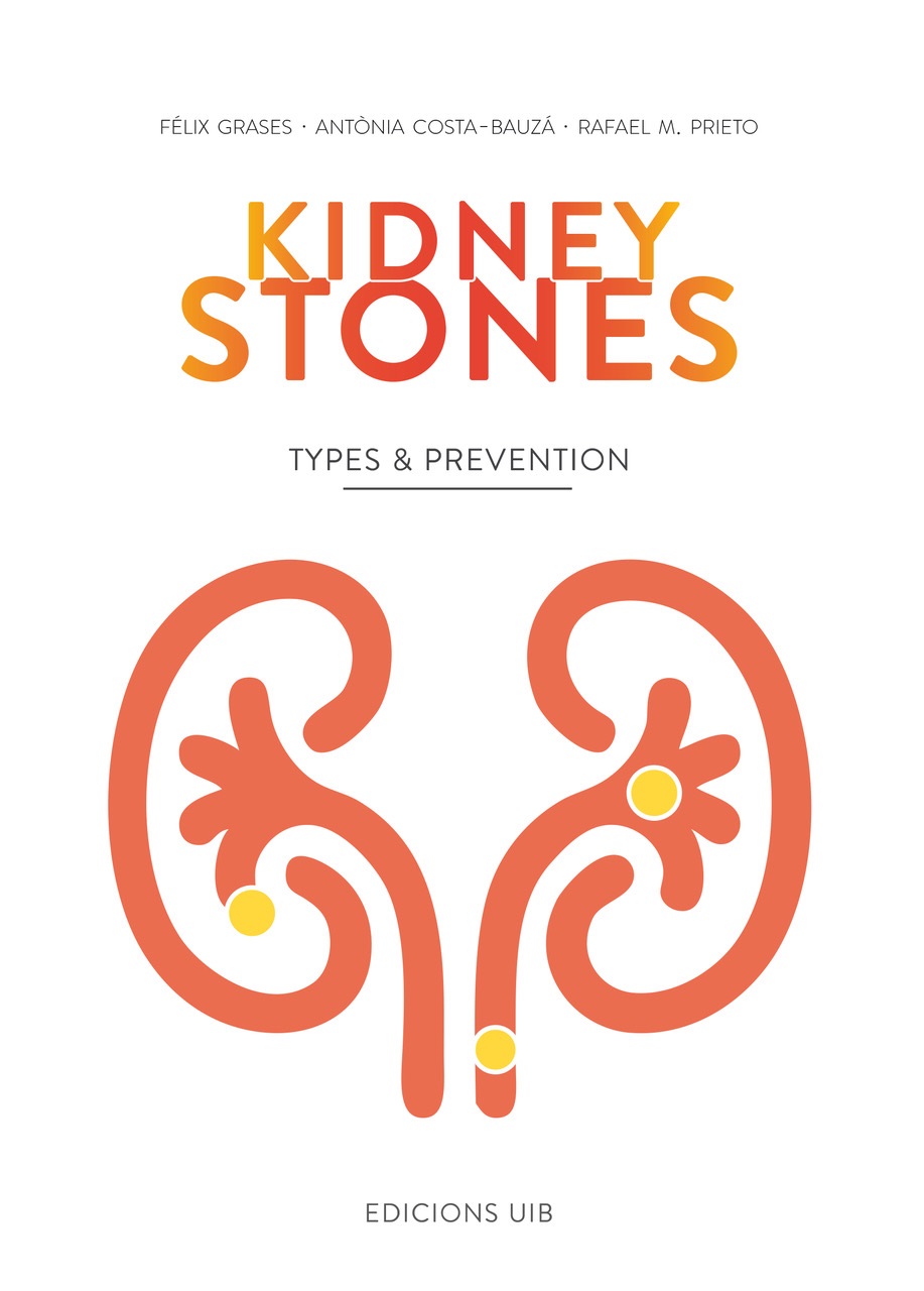 Kidney Stones