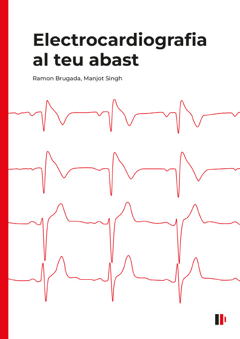 Electrocardiografia al teu abast