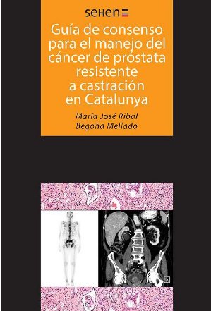 Guías de consenso para el manejo del cáncer de próstata resistente a castración en Catalunya